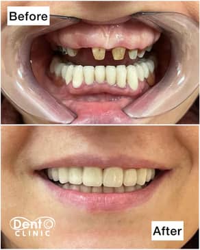 Slider image (3) DENTOCLINIC